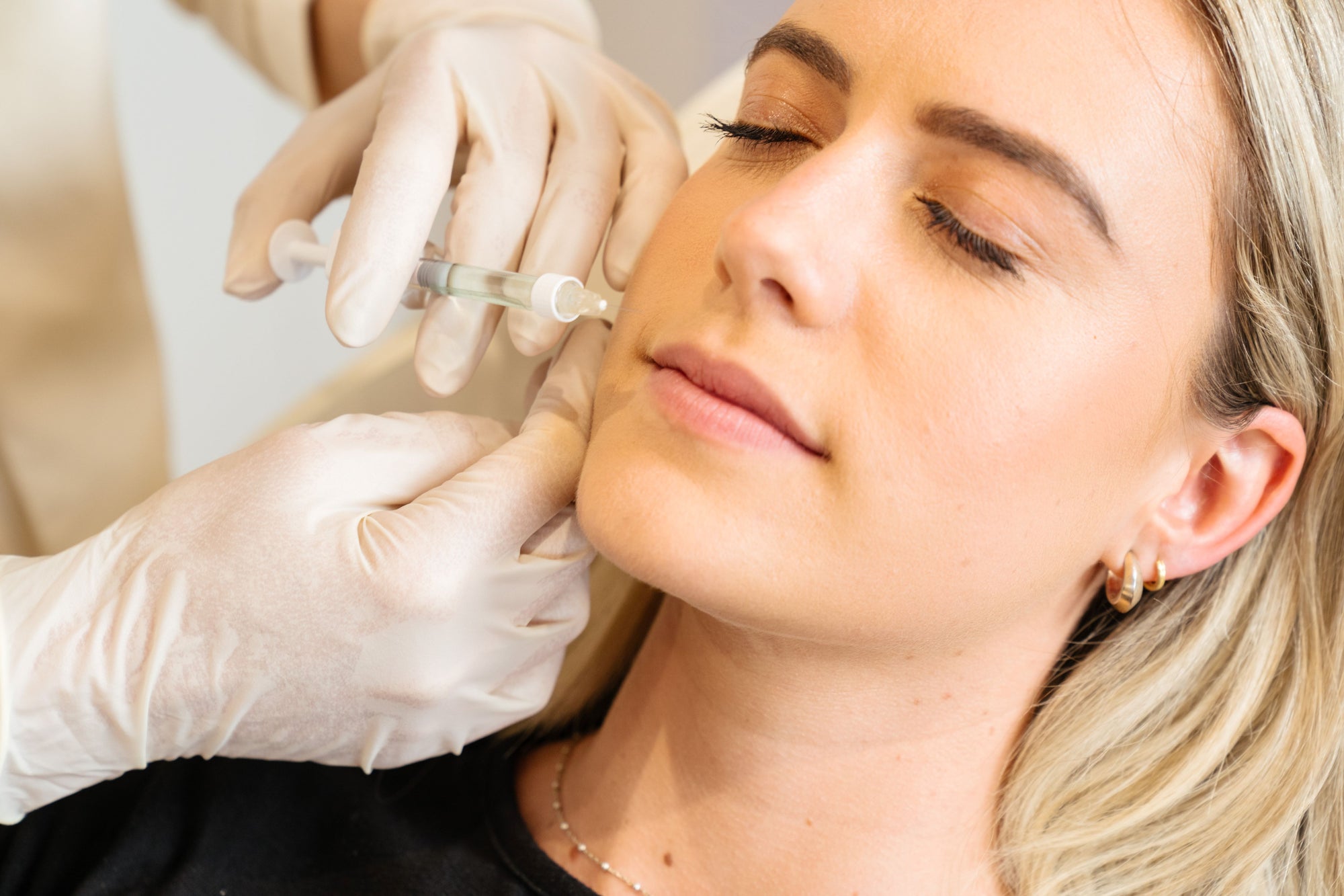 Profhilo: the new cosmetic injectable treatment taking the world by storm