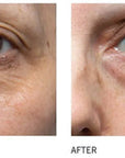C EYE SERUM ADVANCE+ 15ml