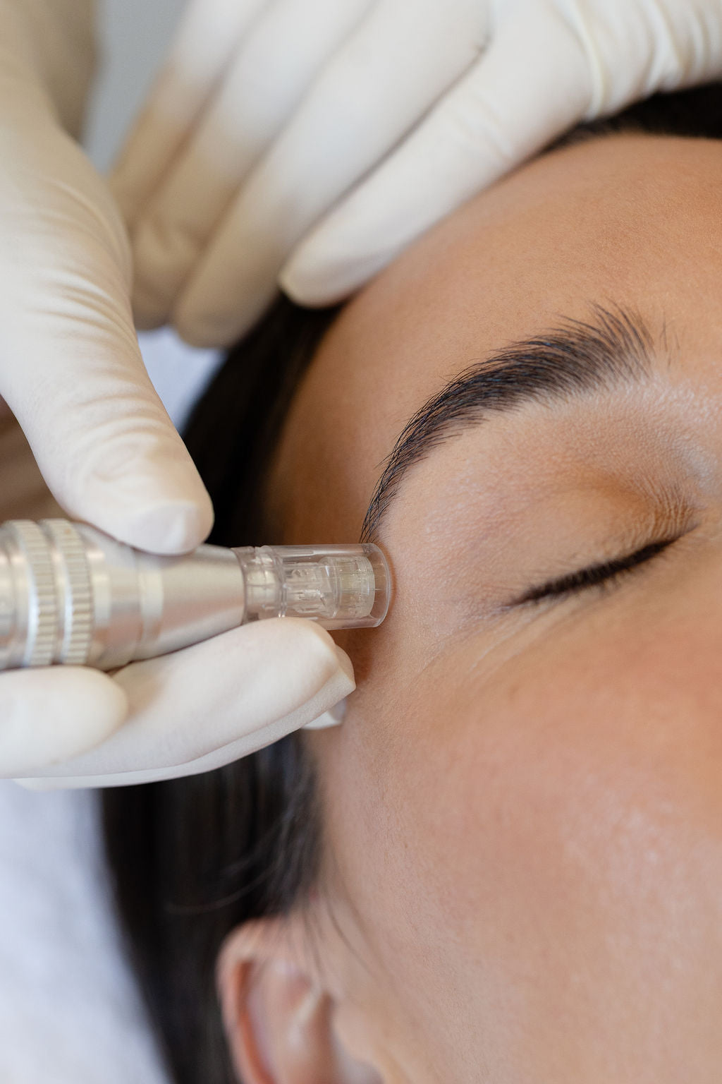 Beyond Glow: The Science Behind Collagen Stimulation with Microneedling