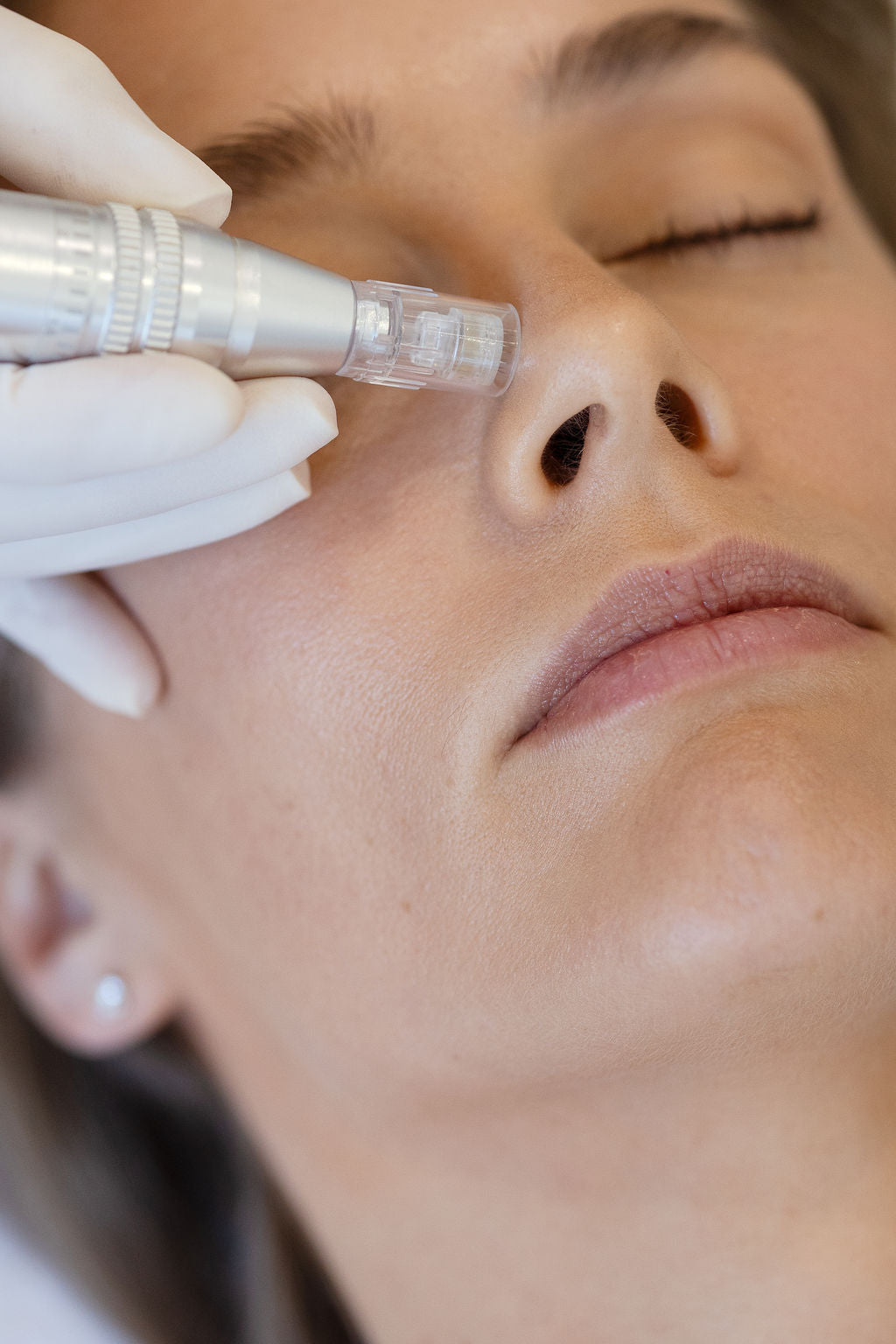 Beyond Glow: The Science Behind Collagen Stimulation with Microneedling