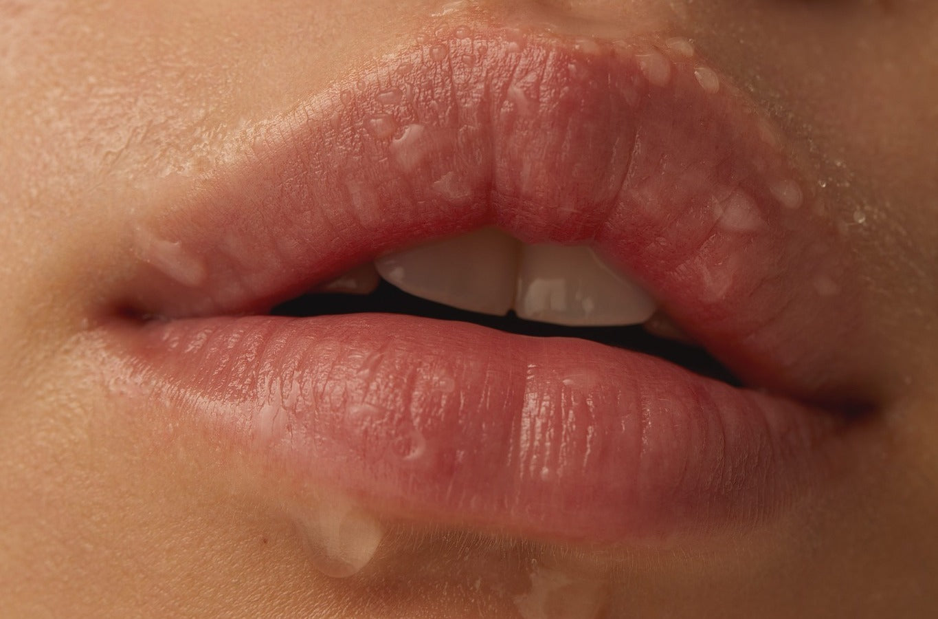 Has my lip filler moved? All you need to know about lip filler migration