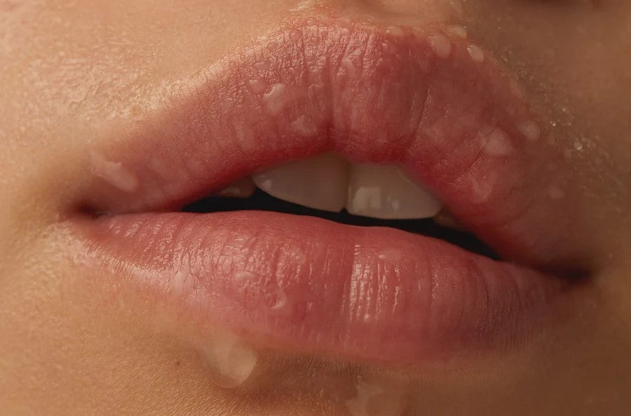 Pout Perfection: Navigating Lip Fillers in Perth