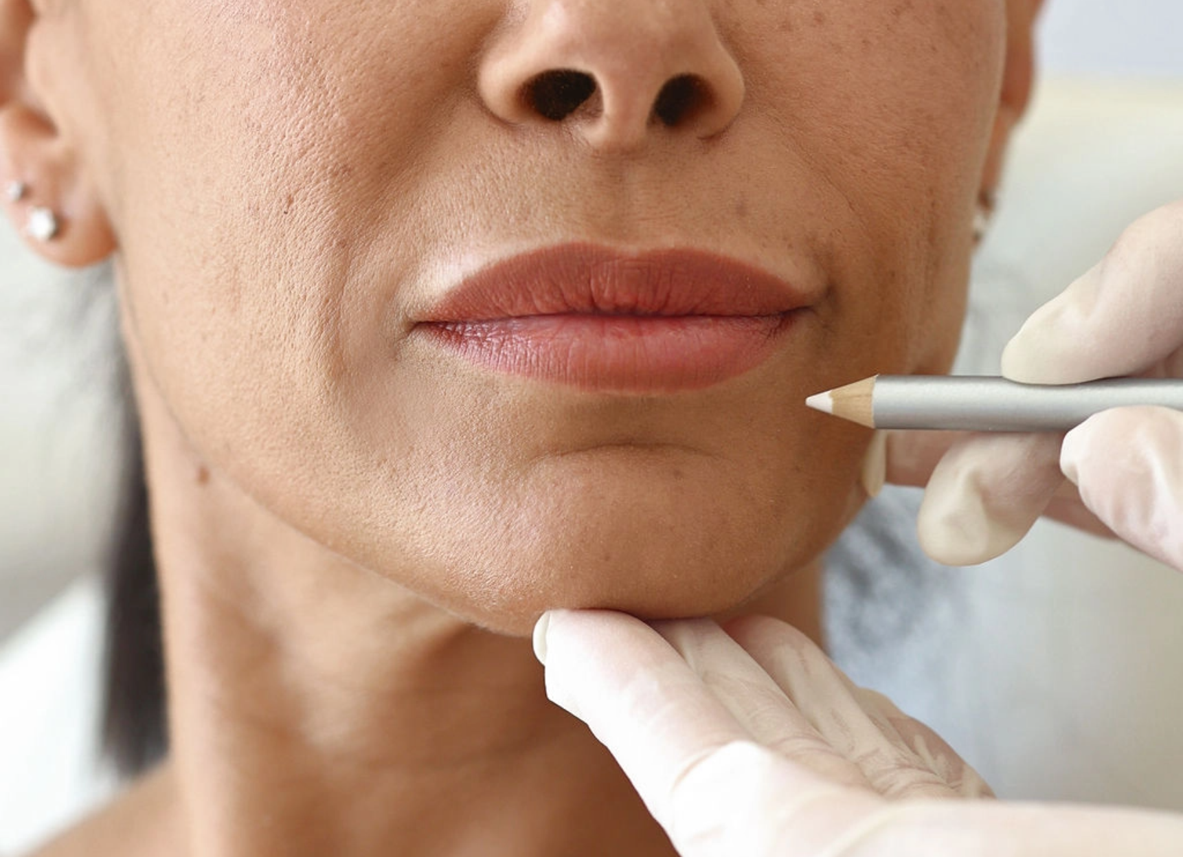 Everything You Need to Know Before Getting Lip Fillers in Perth – A Beginner’s Guide