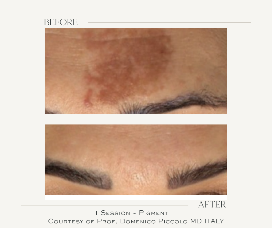 Treatment Image