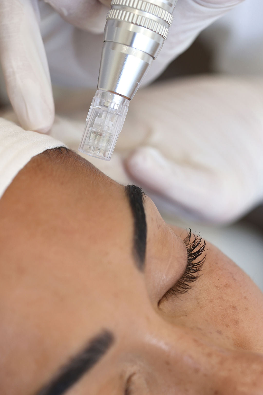 Treatment Image