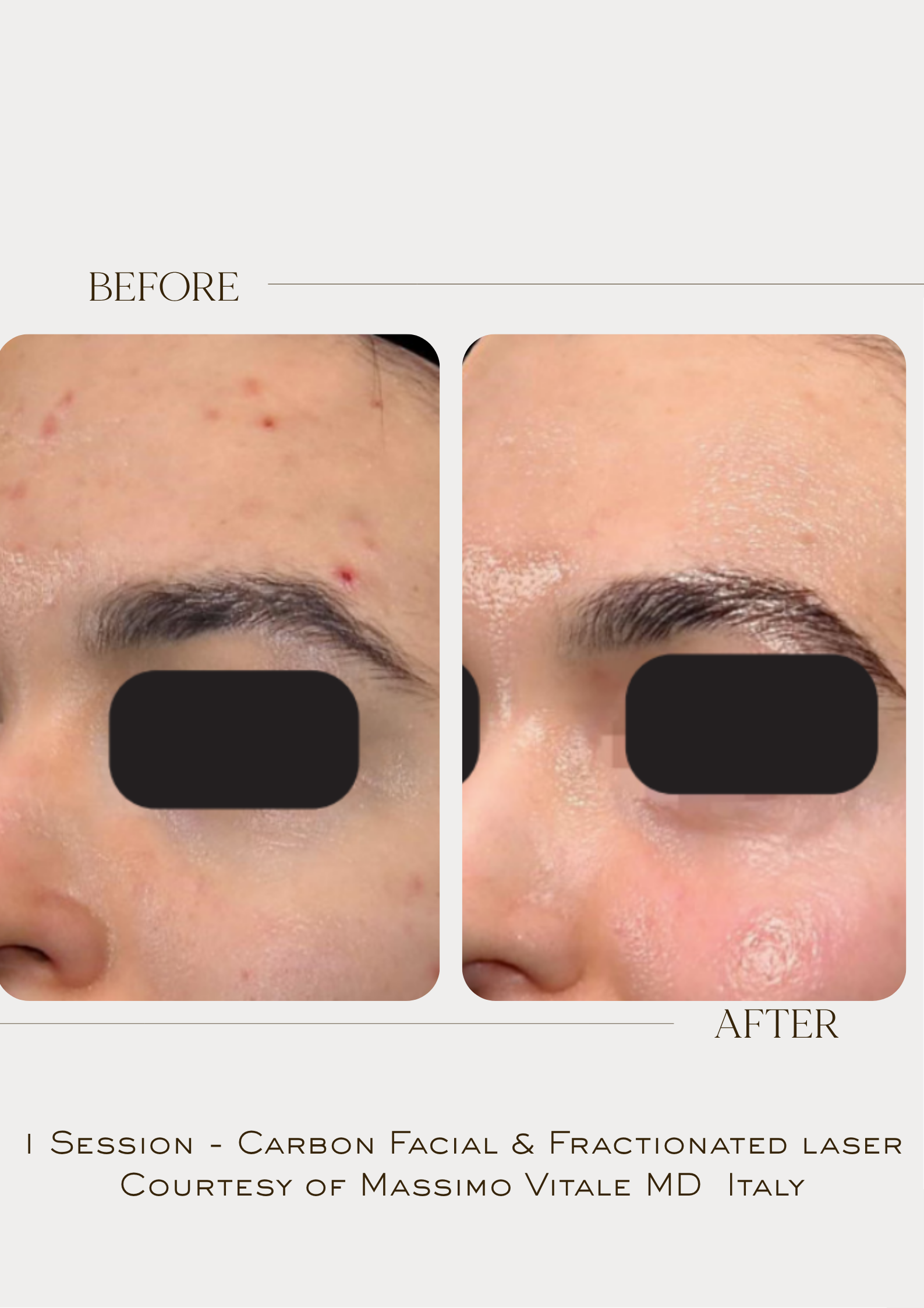 Treatment Image