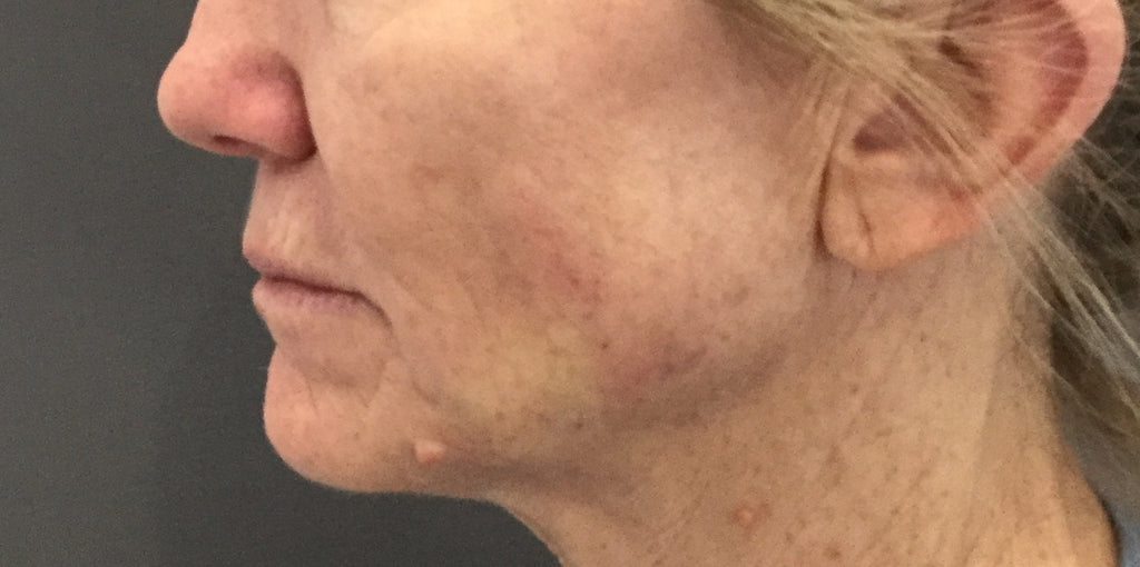 Results – the WHITE ROOM clinic