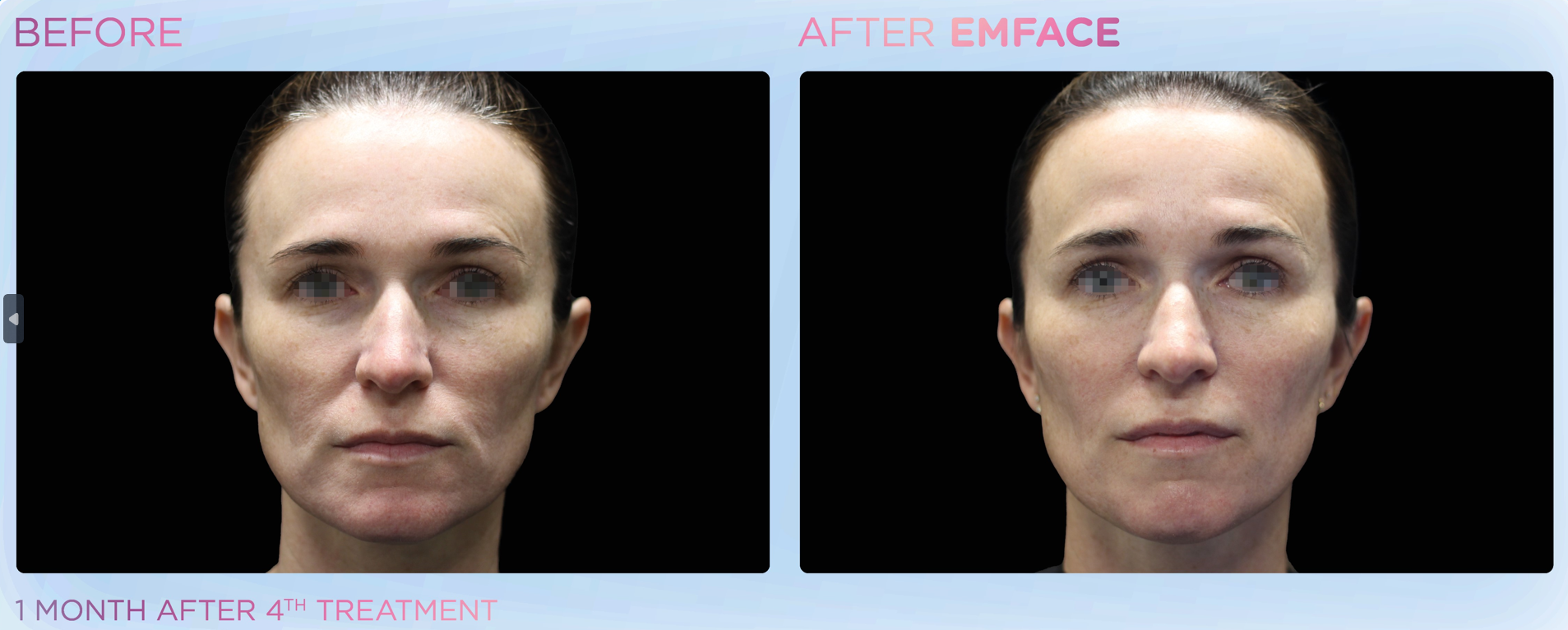 Treatment Image