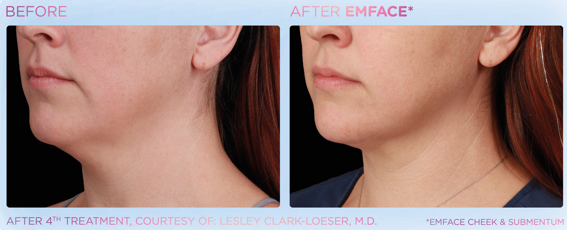 Treatment Image