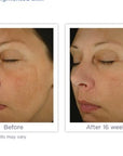BRIGHTENING COMPLEX 30g