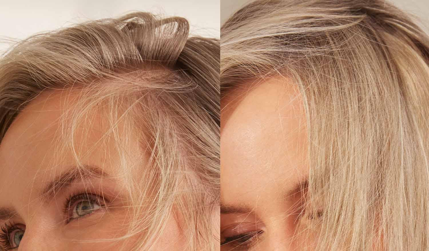 Treatment Image